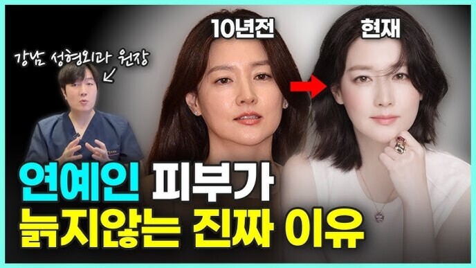강남 성형외과 원장으로 표시된 남성과, 10년 전과 현재로 비교되는 여성의 얼굴 사진이 나란히 배치되어 있다. 아래에는 '연예인 피부가 늙지않는 진짜 이유'라는 굵은 노란색과 하얀색 글씨가 적혀 있다.